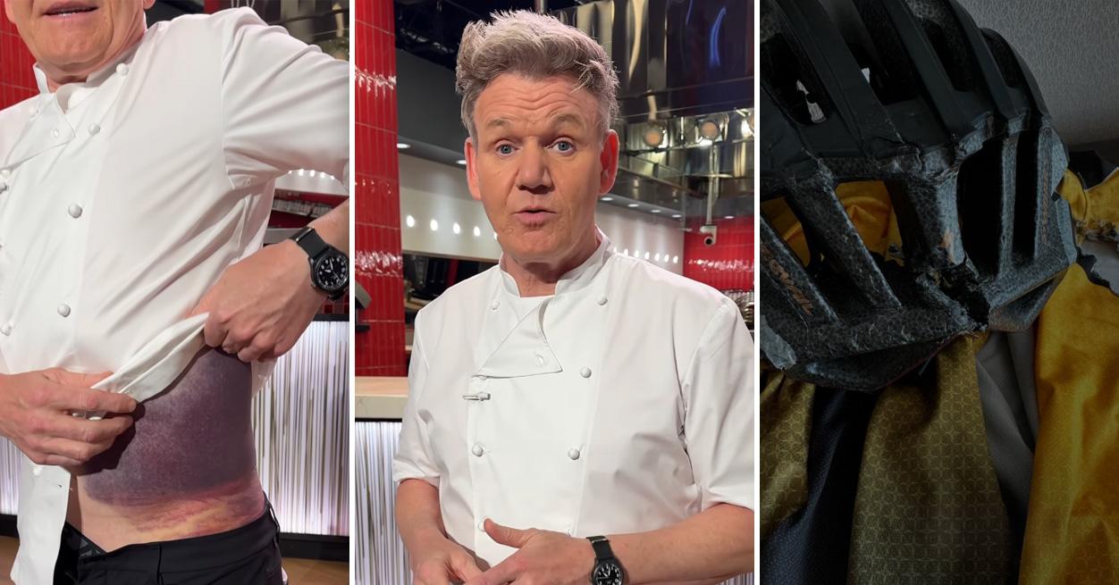 Gordon Ramsay urges bike safety after nasty injury leaves him visibly ...