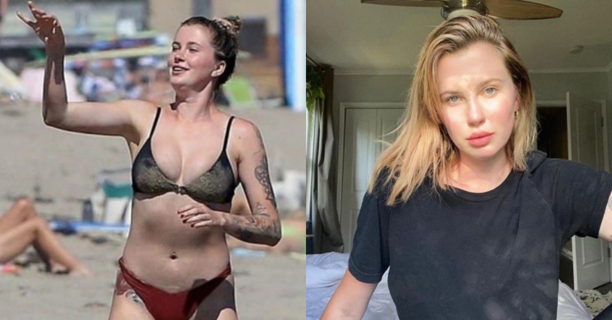 Ireland Baldwin posts paparazzi pics to make a point about the effects of  lighting