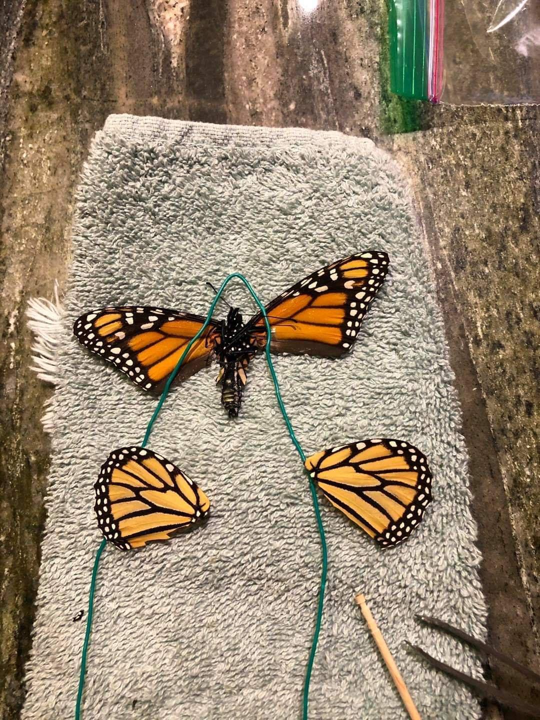 butterfly surgery