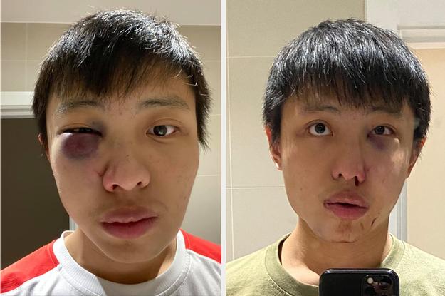 an asian student in london said he assaulted on t    _dblbig